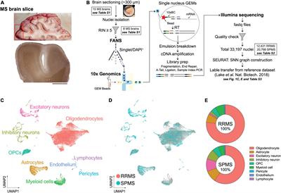 Single-Nucleus RNA-seq of Normal-Appearing Brain Regions in Relapsing-Remitting vs. Secondary Progressive Multiple Sclerosis: Implications for the Efficacy of Fingolimod